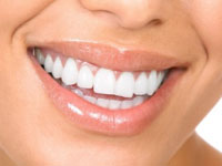 white teeth smile 200